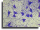 Nerve cells