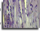 Muscle striations