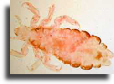 Head louse