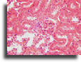 Kidney