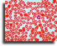 Human blood