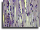Muscle striations