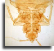 Bedbug