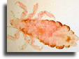 Head louse