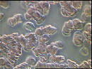 bloodphase1-000.jpg