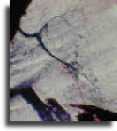 Nerve endings
