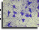 Nerve cells