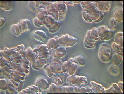 Phase contrast rouleaux