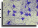 Nerve cells