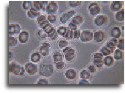 Phase contrast