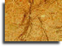 Nerve axons